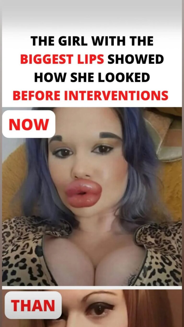 The individual boasting the largest lips on the planet!