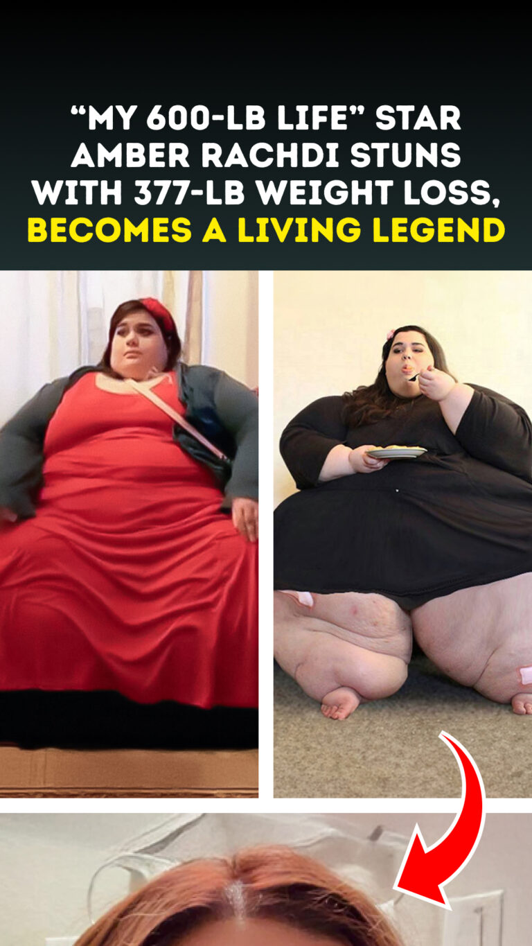 “My 600-lb Life” Star Amber Rachdi Stuns With 377-Lb Weight Loss, Becomes a Living Legend