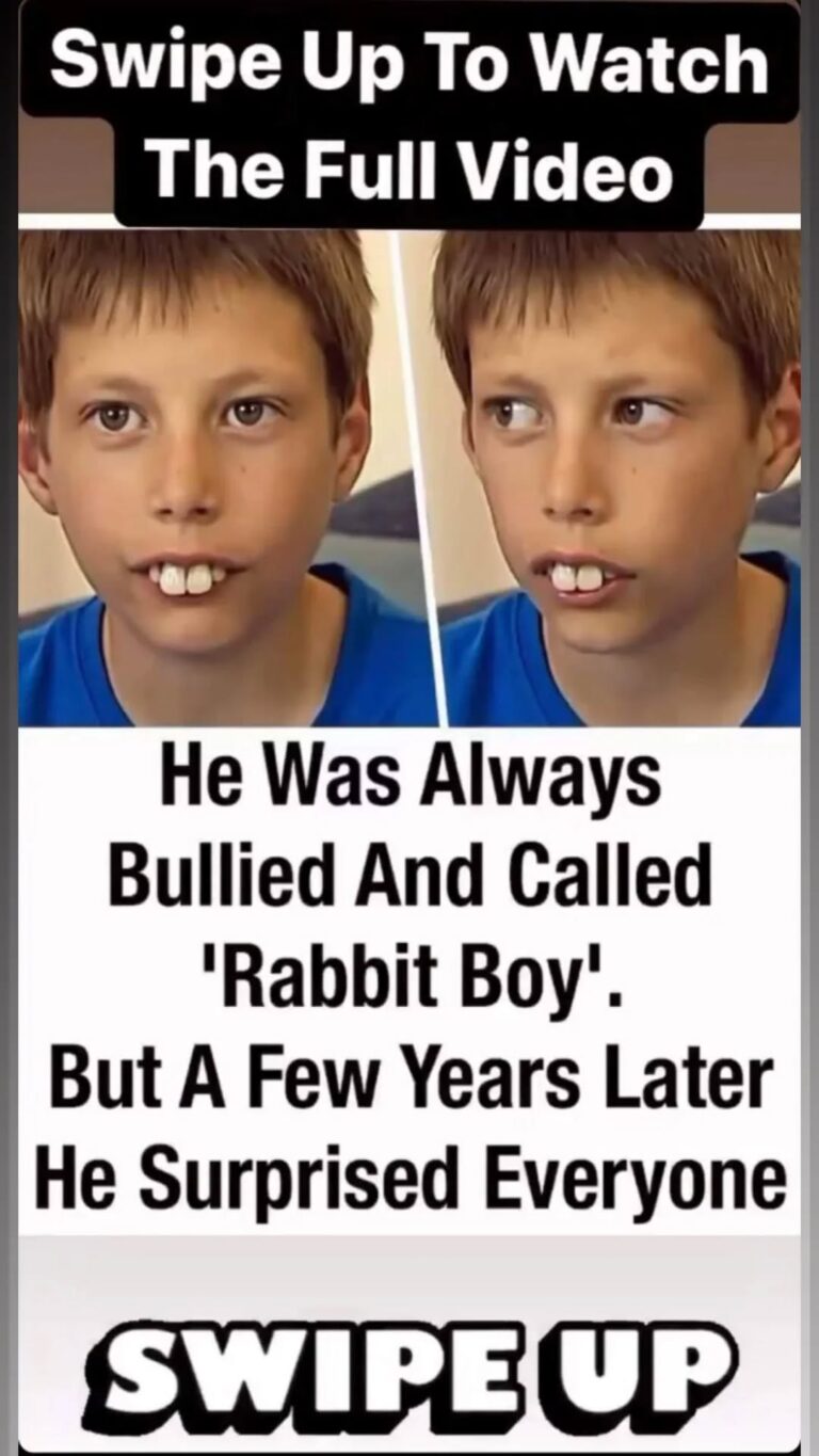 Boy called “rabbit” and bullied for his teeth gets incredible transformation