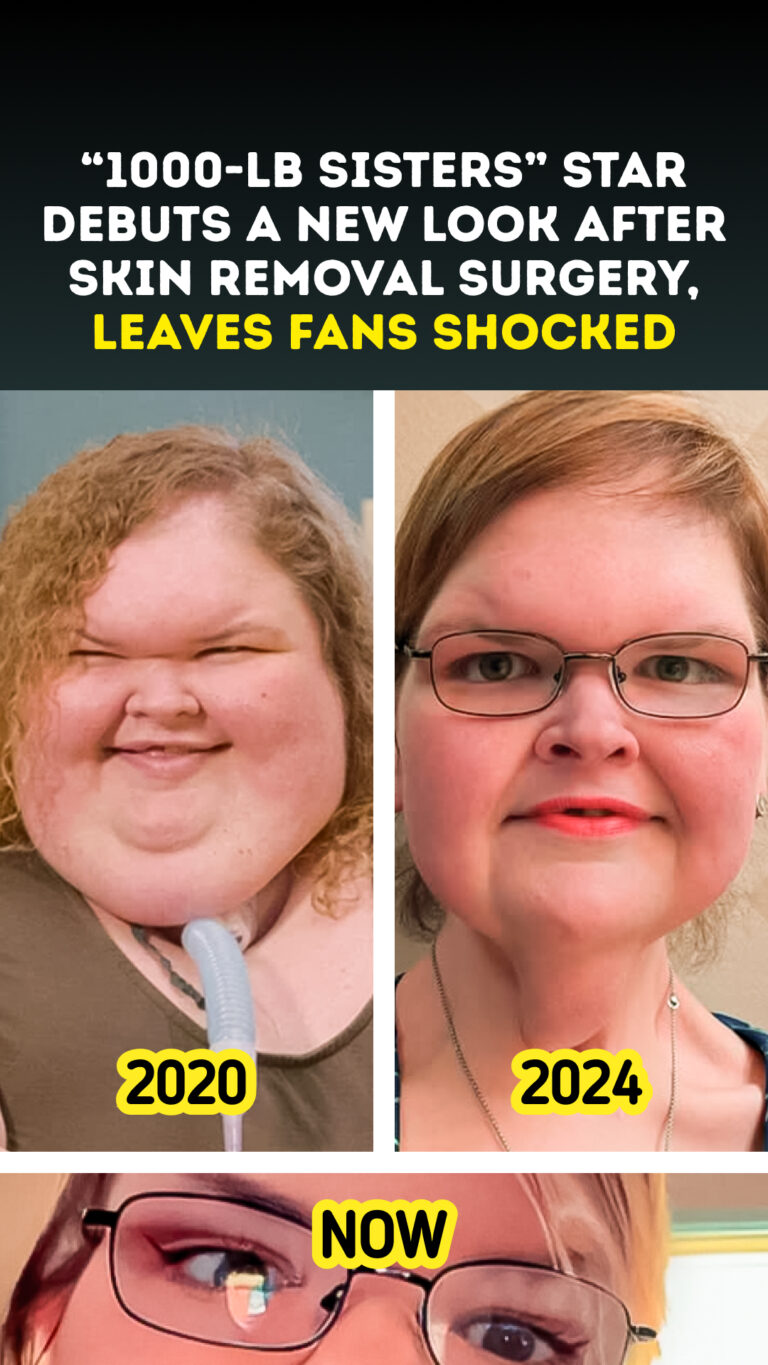 “1000-lb Sisters” Star Debuts a New Look After Skin Removal Surgery, Leaves Fans Shocked