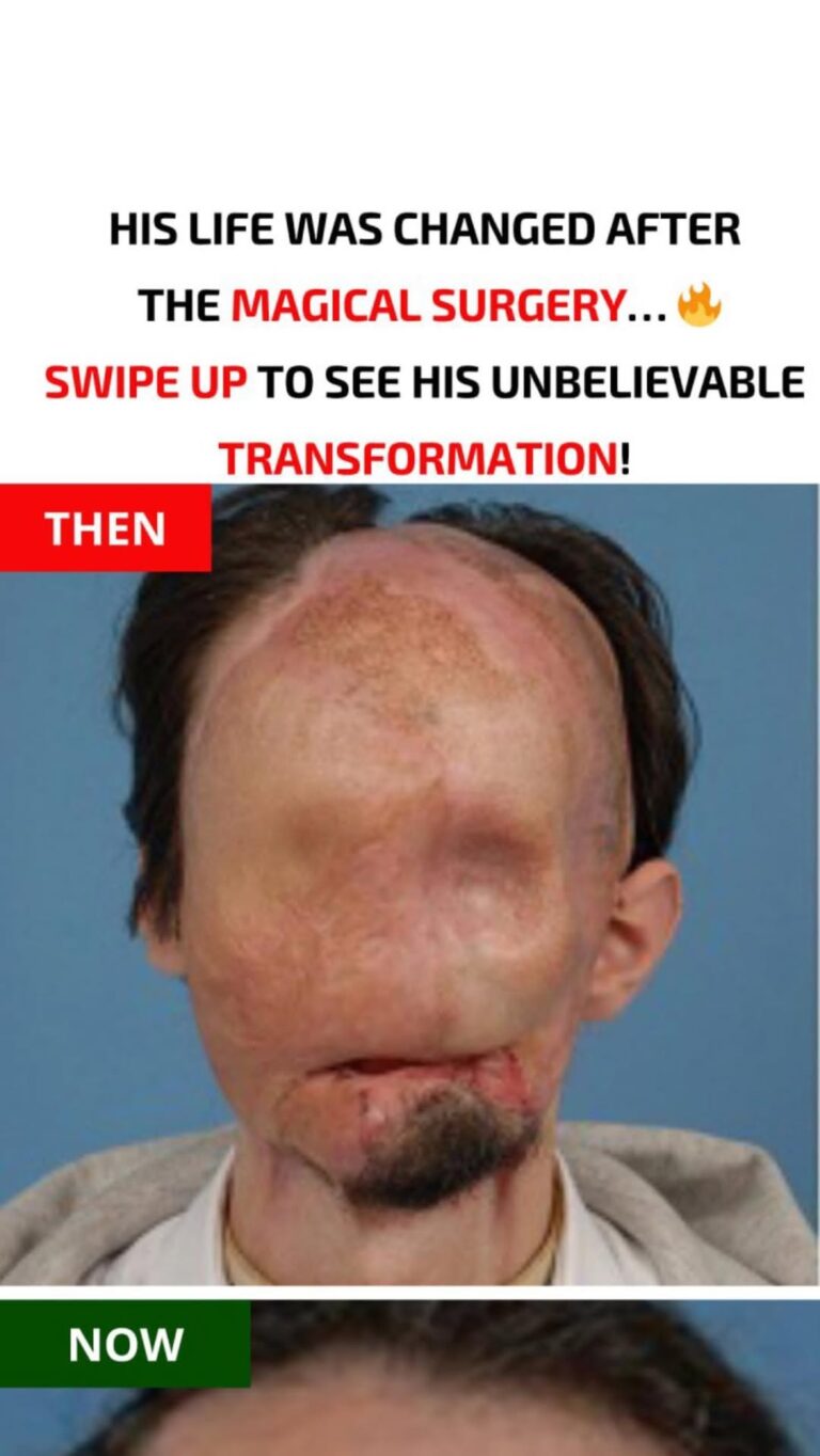 This transformation is incredible… See the result after surgery below…